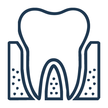 Bone Graft
